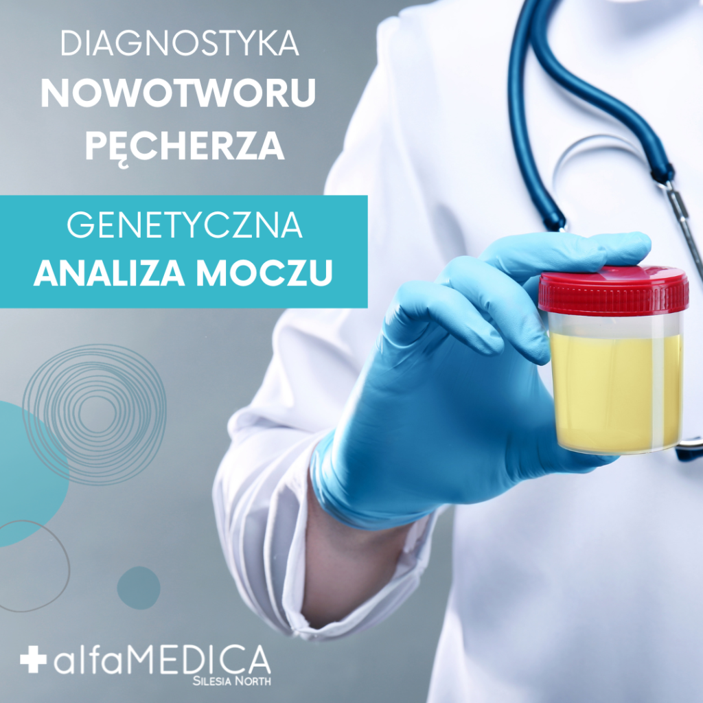 Diagnostyka nowotworu pęcherza Diagnostyka nowotworu pęcherza