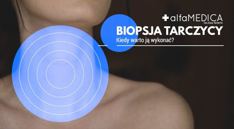 biopsja tarczycy