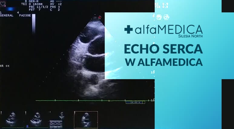 echo serca