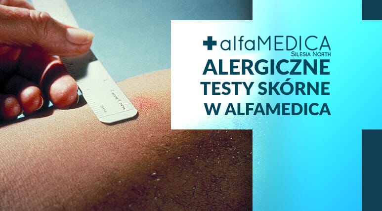 testy alergologiczne