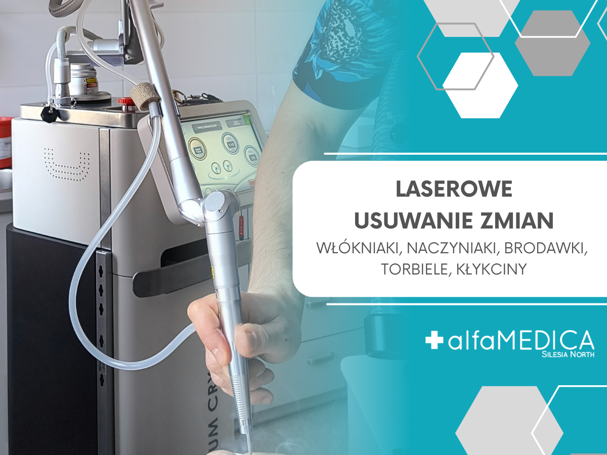 Laserowe usuwanie zmian