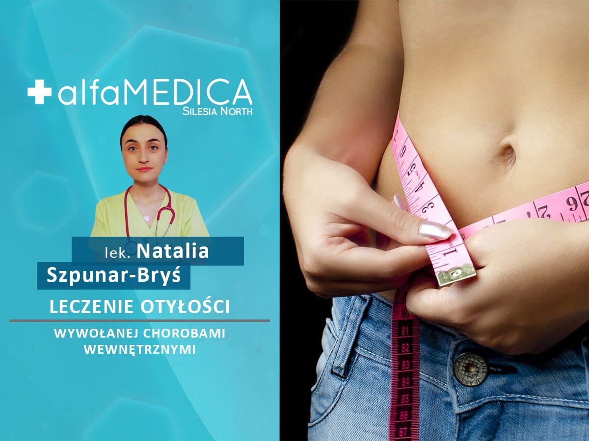 Natalia Szpunar Bryś leczenie otyłości