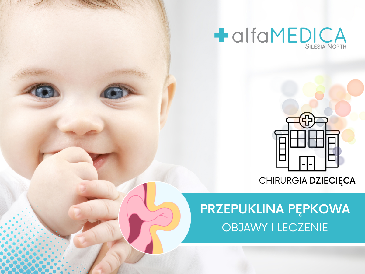 PRZEPUKLINA PĘPKOWA
