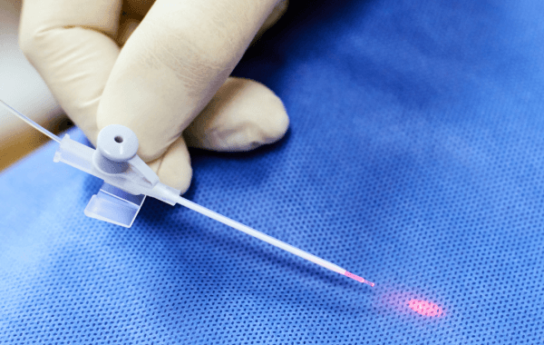 Laserowe leczenie żylaków Laserowe leczenie żylaków