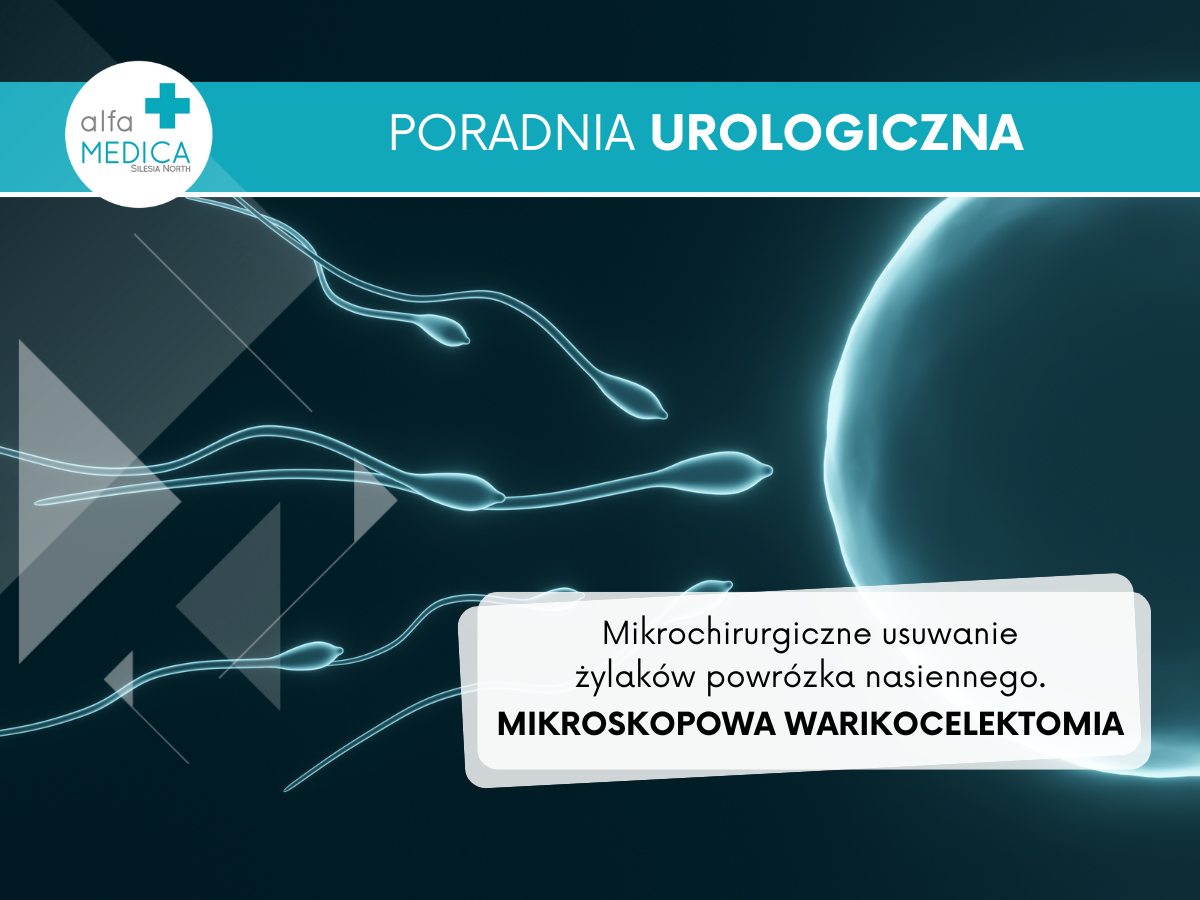 leczenie żylaków powrózka nasiennego