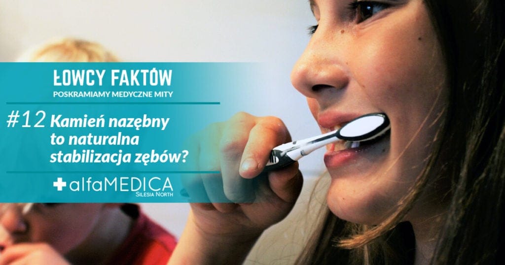 kamień nazębny